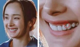 明星爆料烤瓷牙视频播放,揭秘明星美牙背后的秘密